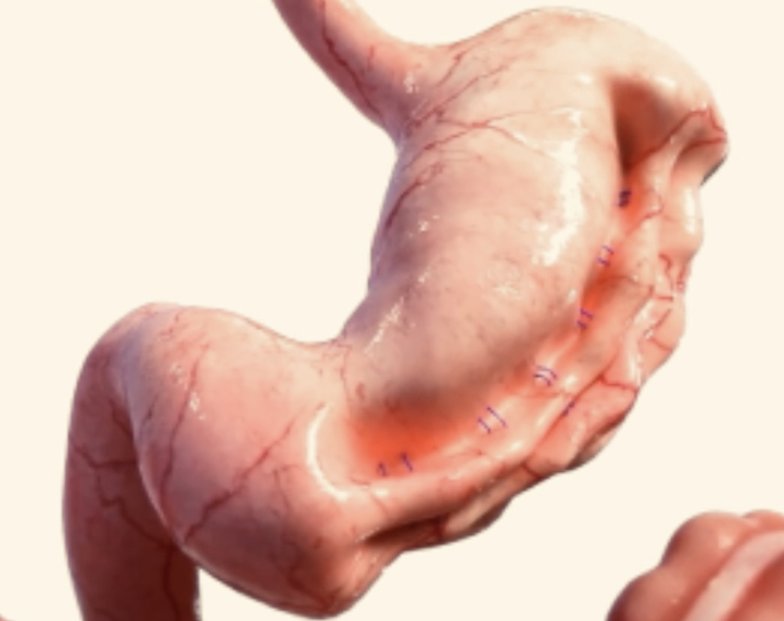 ESG Procedure Dr. Miro Uchal