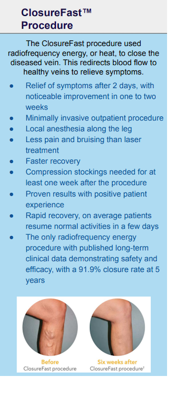 Fast Vein Disease Treatment