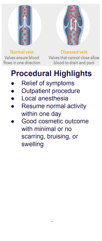 Affordable Vein Disease Treatment in Florida